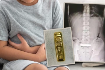 சீனாவில் தங்கத்தை விழுங்கிய சிறுவன் ; 5 நாட்கள் மகனை வீட்டுக்குள் அடைத்த தாய்