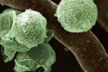 இந்தியாவில்  கறுப்பு, வெள்ளையை தொடர்ந்து பச்சை பூஞ்சை நோய்