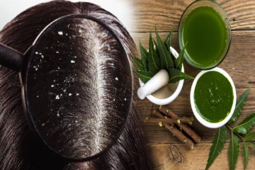 தலையில் பொடுகு தொல்லை அதிகமா? இந்த ஒரு இலை இருந்தால் தீர்வு கொடுக்கும்