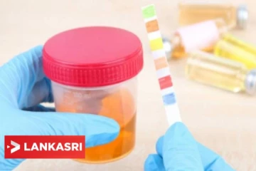 சிறுநீர் நிறம் மாற காரணம் என்ன? உங்கள் சிறுநீரின் நிறம் இதுவென்றால் இந்த பிரச்சினையாக இருக்கலாம்!