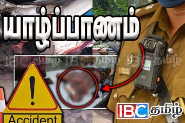 யாழைச் சேர்ந்த குடும்பஸ்தரின் கால் துண்டிப்பு - கோர விபத்தால் நேர்ந்த துயரம்