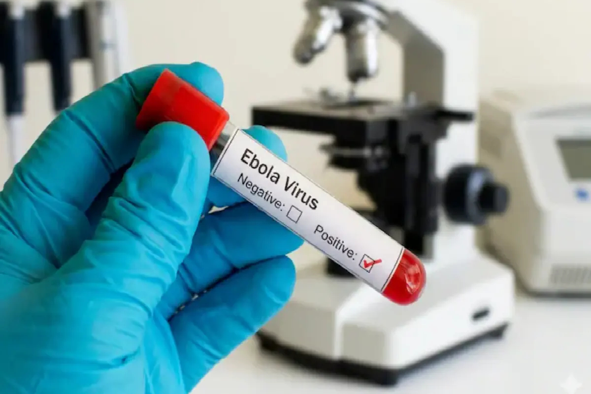 இந்தியாவிலும் புகுந்த எபோலா வைரஸ்; தனிமைப்படுத்தப்பட்ட பெண் | Ebola Virus India Bengaluru Woman Quarantined