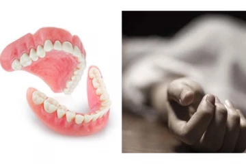 தண்ணீர் குடிக்கும்போது பல் செட்டை விழுங்கிய பெண்- பரிதாபமாக இறந்த சம்பவம்!