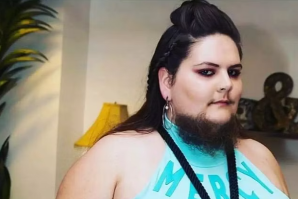17 வருடங்களாக முகத்தில் தாடியுடன் இளம்பெண் - காரணம் இதுதான்! | American Bearded Woman