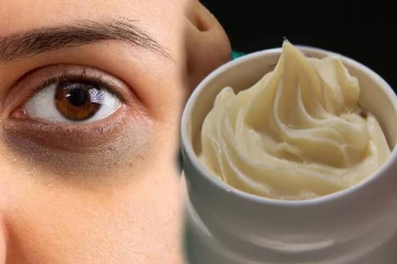 கருவளையம் நிரந்தரமாக நீங்க உதவும் இயற்கை கிரீம்: எப்படி தயாரிப்பது?