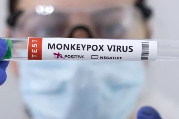 குரங்கம்மை நோய் தொடர்பில் மக்களுக்கான அறிவிப்பு