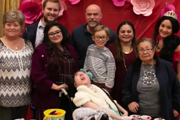 மூளையின் பெரும்பகுதி இல்லை; மருத்துவ உலகின் கணிப்பை பொய்யாக்கிய அமெரிக்க யுவதி! | Us Women Missing Part Brain Celebrate 20 Birthday