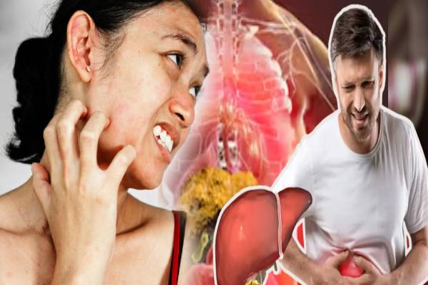 தோலில் இந்த அறிகுறிகள் இருக்கா? அப்போ கல்லீரல் ஆபத்தில் இருக்குதுன்னு அர்த்தம்! | What Are The Warning Signs Of A Damaged Liver