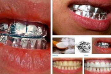 பற்களில் மஞ்சள் கறையால் அசிங்கப்படுகிறீர்களா? 1 மணி நேரத்தில் நிகழும் அற்புதம்