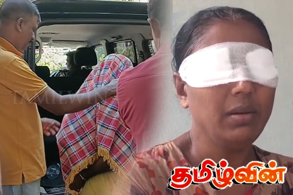 கொள்ளையனின் மோசமான செயலால் பெண்ணுக்கு ஏற்பட்ட பெரும் துயரம் | Thief Used Powder Women Lost Her Vision