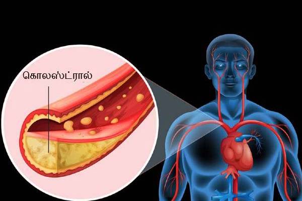 முகத்தில் கொலஸ்ட்ரால் அறிகுறிகள்: உங்கள் கண்களுக்கு கீழ் இப்படி உள்ளதா? | Cholesterol Symptoms On The Face