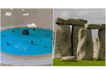சிறுநீரகத்திலிருந்த கற்களைக் கொண்டு Stonehenge சிற்பத்தை உருவாக்கிய நபர்...!