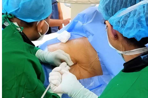 Suparma File Surgery இலங்கையில் முதன்முறையாக நடந்த அபூர்வ சத்திர சிகிச்சை - கனடாமிரர்