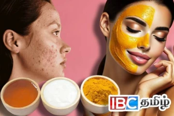 முகத்தில் கரும்புள்ளிகளால் அவதிப்படுகின்றீர்களா... இதோ சிறந்த தீர்வு...