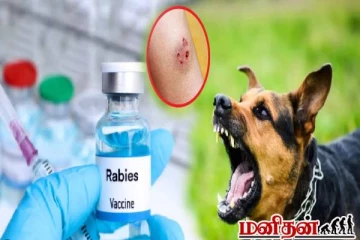 நாய் கடித்தால் இவ்வளவு நோய் அபாயம் இருக்கா! எத்தனை மணி நேரத்தில் ரேபிஸ் ஊசி போடணும்?