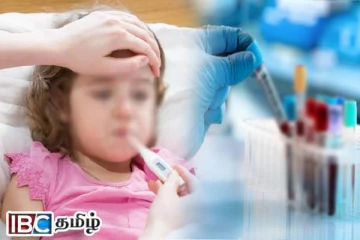 சிறுவர்களிடையே பரவும் வைரஸ் காய்ச்சல் : விடுக்கப்பட்டுள்ள எச்சரிக்கை