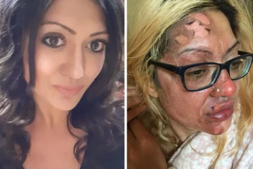 முட்டையால் பிரித்தானிய பெண்ணுக்கு நேர்ந்த சோகம்!