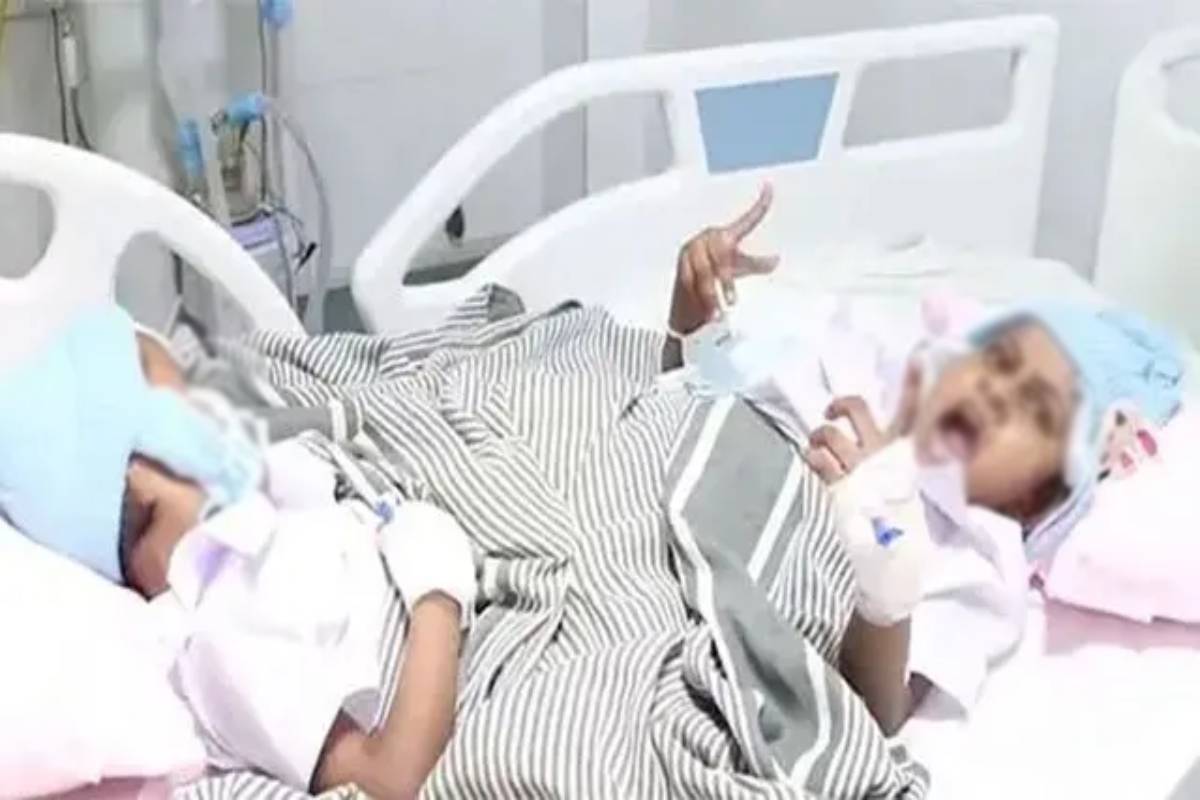 ஒட்டிப் பிறந்த இரட்டையர்கள்: இலங்கை வைத்தியர்கள் வரலாற்றுச் சாதனை! | Conjoined Twins Successfully Separated At Peradeni ஒட்டிப் பிறந்த இரட்டையர்கள்: இலங்கை வைத்தியர்கள் வரலாற்றுச் சாதனை! | Conjoined Twins Successfully Separated At Peradeni