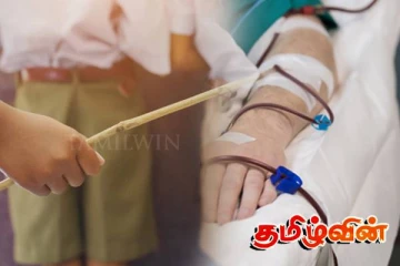 யாழில் உள்ள பாடசாலையில் ஆசிரியர் தாக்கியதில் மாணவன் வைத்தியசாலையில்!