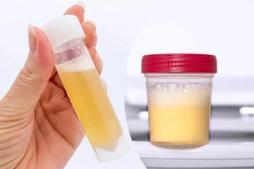 சிறுநீரில் வெள்ளை நிற நுரை இருந்தால் ஆபத்தா? பலரும் அறியாத உண்மை