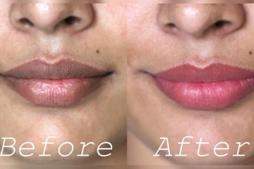 உதடு கருமையாக உள்ளதா? இதனை நீக்க இதோ அசத்தலான டிப்ஸ்!