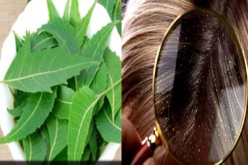 பொடுகு பிரச்சினைக்கு ஒரு கை பிடி வேப்பிலை போதுமா? பலரும் அறியாத உண்மை