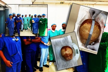 வெற்றிகரமாக அகற்றப்பட்ட இராட்சத சிறுநீரக கல்: திருகோணமலை வைத்தியசாலையில் சாதனை: