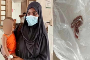 ஒன்றரை வயது குழந்தை கடித்ததால் உயிரிழந்த விஷப்பாம்பு! நம்பமுடியாத ஆச்சரிய சம்பவம்... புகைப்படம்