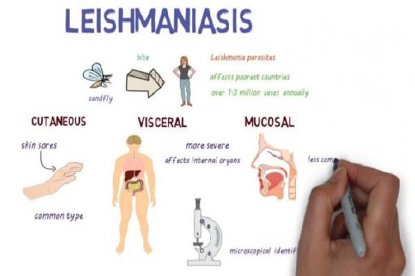 leishmaniasis-symptoms: லீஷ்மேனியாசிஸ் என்றால் என்ன? இந்த அறிகுறிகள் இருந்தா ஜாக்கிரதை! | Kalaazar Visceral Leishmaniasis Symptoms In Tamil