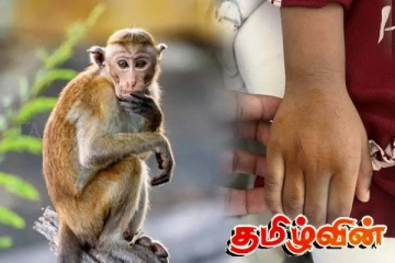 மானிப்பாய் பிரதேச சபையின் பொறுப்பற்ற செயல் - சிறுமியின் கையை பதம் பார்த்த குரங்கு