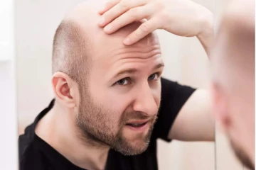 வழுக்கை தலையை கேலி செய்வதும் பாலியல் குற்றம் - ஆண்களுக்கு மகிழ்ச்சியை கொடுத்த தீர்ப்பு