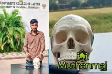 மூளையில் உள்ள கட்டிகளை அடையாளம் காண கண்டுபிடிக்கப்பட்டுள்ள புதிய இயந்திரம்