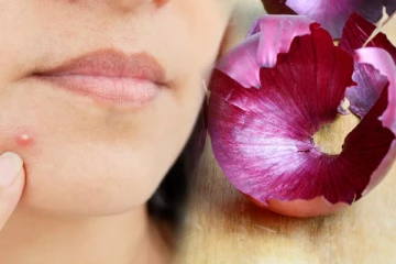 உங்களுக்கு முகப்பரு தொல்லையா? தூக்கி ஏறியும் வெங்காயத்தோலை இப்படி யூஸ் பண்ணுங்க போதும்!