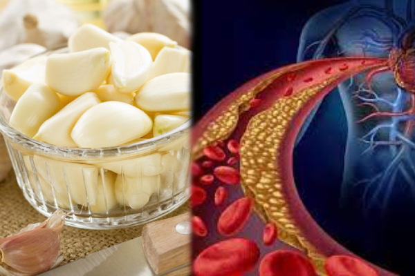 கொலஸ்டோல் காரணமாக அவஸ்தைப்படுபவர்களா?? இனி அந்தக் கவலையே வேண்டாம் - இதனைச் செய்தாலே போதும் - ஐபிசி தமிழ்