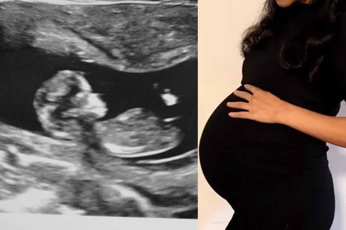 ஒரே பிரசவத்தில் நான்கு பெண் குழந்தைகளை பெற்றெடுத்த வெளிநாட்டு பெண் | Australia Woman Gives Birth To Quadruplet Girls ஒரே பிரசவத்தில் நான்கு பெண் குழந்தைகளை பெற்றெடுத்த வெளிநாட்டு பெண் | Australia Woman Gives Birth To Quadruplet Girls