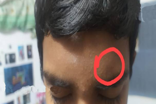 யாழில் பிரபல பாடசாலை மாணவனை கொடூரமாக தாக்கிய ஆசிரியர்! | Teacher Assaulted A Popular School Student Jaffna