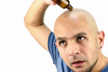 இந்த மொட்டை தலையில் கூட முடி கொத்து கொத்தா வளர இத தடவுங்க.... !