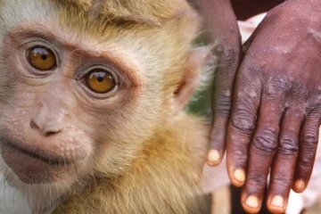 මන්කිපොක්ස් හෙවත් වඳුරු උණට ප්‍රතිකාර කරන්නේ මෙහෙමයි..