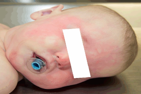 விளையாட்டால் ஏற்பட்ட விபரீதம் - பறிபோன இரண்டுமாத சிசுவின் உயிர் | Brother Killed Sister While Playing