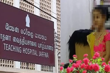 சிறுமியின் கை அகற்றப்பட்ட விவகாரம் : நீள்கின்றது மருத்துவமனை விசாரணை