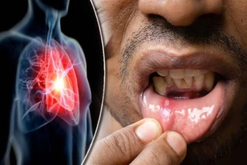 Heart Attack Symptoms: வாயில் இந்த அறிகுறி இருக்கா? மாரடைப்பு வருமாம்- உஷாரா இருங்க