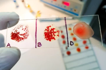 தங்க ரத்தம்…மனிதர்களுக்கு இருக்கும் மிக அரிய ரத்தத்தில் இவ்வளவு சிறப்பா?