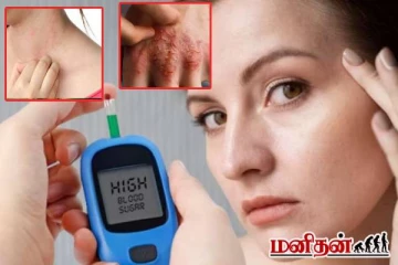 நீரிழிவு நோயின் எச்சரிக்கை அறிகுறிகள் என்னென்ன தெரியுமா? அலட்சியப்படுத்தினால் ஆபத்து!