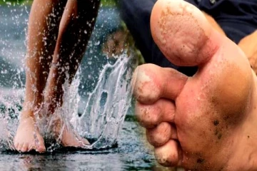 மழைக்காலம் வந்தாச்சு! சேற்றுப் புண்ணுக்கு என்ன வைத்தியம்னு தெரிஞ்சுவெச்சுக்கங்க