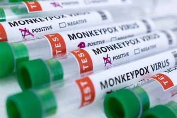 குரங்கம்மையின் பெயரை மாற்றிய உலக சுகாதார அமைப்பு!