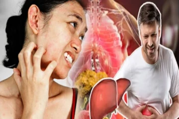 தோலில் இந்த அறிகுறிகள் இருக்கா? அப்போ கல்லீரல் ஆபத்தில் இருக்குதுன்னு அர்த்தம்