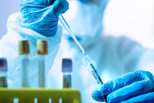 உலுக்கும் கொரோனா; அனைவருக்கும் ஆர்டிபிசிஆர் பரிசோதனை கட்டாயம் - பொது சுகாதாரத் துறை - தமிழ்நாடு