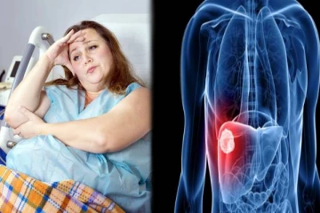 உடல் பருமன் கல்லீரல் புற்றுநோயை உண்டாக்கும்: மருத்துவர்களின் எச்சரிக்கை