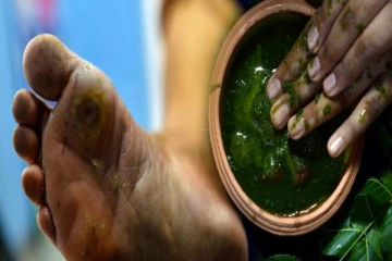 இந்த இலையை அரைச்சு போடுங்க- சர்க்கரை வியாதியால் வரும் குழிப்புண்களுக்கு உடனடி தீர்வு