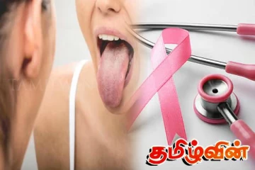 இலங்கையில் வேகமாகப் பரவி வரும் நோய்! மக்களுக்கு வெளியான எச்சரிக்கை